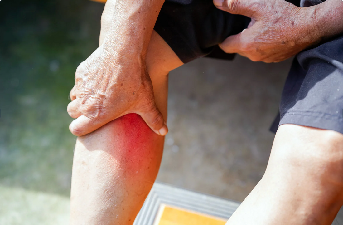 Swelling That Doesn’t Respond to Massage: What’s Really Going On