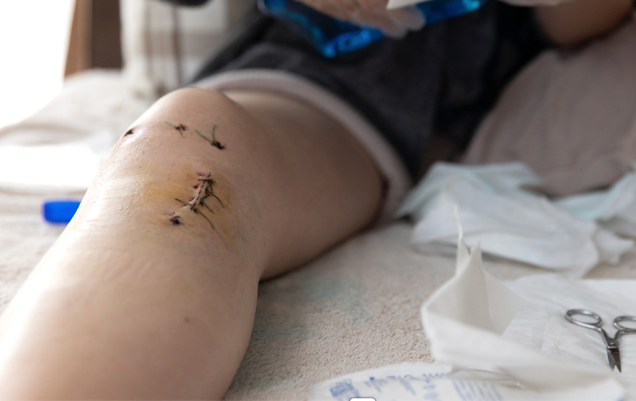 Post-Surgical Clinical Lymphatic Drainage and Recovery
